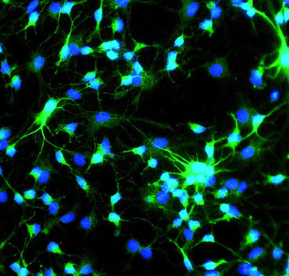 MAP-2 immunoreactivity in neurosphere cultures from an e18 mouse brain (1:1000 dilution, green); 2˚ antibody was a fluorescein-labeled goat anti-chicken IgY (Aves Labs Cat No. F-1005, 1:500 dilution). Blue staining is DAPI nuclear stain. (Hoda Ilias, Aves Labs.)