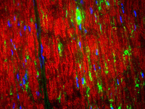 Immunohistochemical staining of the MBP (green) in the nodes of Ranvier of the sciatic nerve of an adult rat. Red counterstaining is a ubiquitous gene product. Blue shows DAPI nuclear staining. Photomicrograph courtesy of Dr. Gerry Shaw, Univ. Florida.