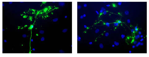 Chicken anti-Myelin Basic Protein (MBP) (green), with nuclei stained with Hoechst dye (blue).