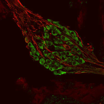 Metabotropic glutamate receptor type 1 (1:1000 dilution, green) immunoreactivity and neurofilament-M (NF-M, rabbit antibody, 1:500 dilution) immunoreactivity in a tissue section through an e18 mouse cochlear ganglion.