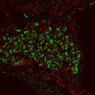 Metabotropic glutamate receptor type 1 (1:1000 dilution, green) immunoreactivity and neurofilament-M (NF-M, rabbit antibody, 1:500 dilution) immunoreactivity in a tissue section through an e18 mouse cochlear ganglion.