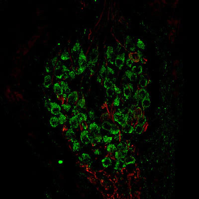 Metabotropic glutamate receptor type 1 (1:1000 dilution, green) immunoreactivity and neurofilament-M (NF-M, rabbit antibody, 1:500 dilution, red) immunoreactivity in a tissue section through an e18 mouse cochlear ganglion.