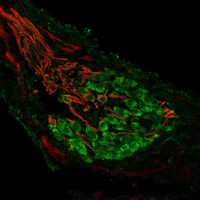 Metabotropic glutamate receptor type 2 (mGluR2, 1:1000 dilution, green) immunoreactivity and neurofilament-M (NF-M, rabbit antibody, 1:500 dilution, red) immunoreactivity in a tissue section through an e18 mouse cochlear ganglion.