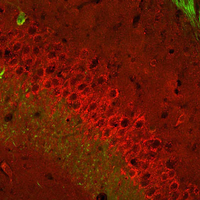 Metabotropic glutamate receptor type 2 (mGluR2, 1:1000 dilution, green) immunoreactivity and neurofilament-M (NF-M rabbit antibody, 1:500 dilution, red) immunoreactivity in a tissue section through the CA3 hippocampal formation of an e18 mouse embryo.