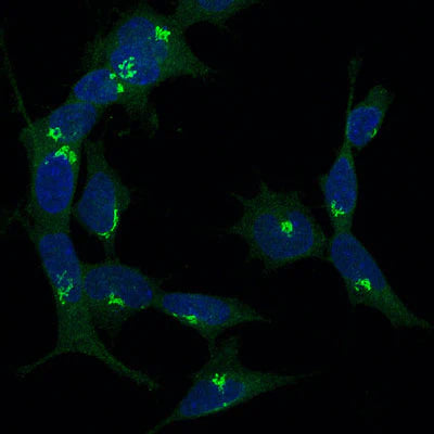 Immunocytochemistry showing nestin immunoreactivity (green; 1:1000 dilution) in A7r5 neuroblastoma cells in culture. Blue is DAPI nuclear staining. Page Balich, Univ. Arizona.