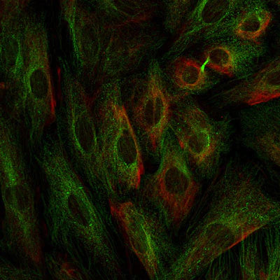 Photomicrograph of A7r5 neuroblastoma cells in culture. Nestin immunoreactivity (red staining, Aves Labs, 1:1000 dilution; green is β-Tubulin 3 staining using a rabbit antibody (Rockland, 1:500 dilution); blue is DAPI nuclear staining. Page Balich, Univ. Arizona.