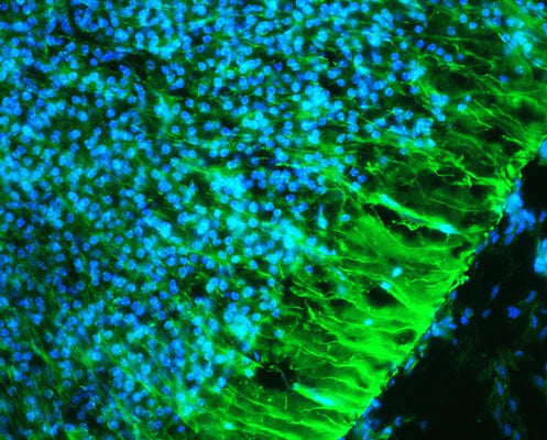 Photomicrograph of a tissue section through the periventricular zone of an e16 mouse brain (4.0% paraformaldehyde-fixed). Green is nestin immunoreactivity (1:1000 dilution). Blue is DAPI nuclear staining. Hoda Ilias, Aves Labs.