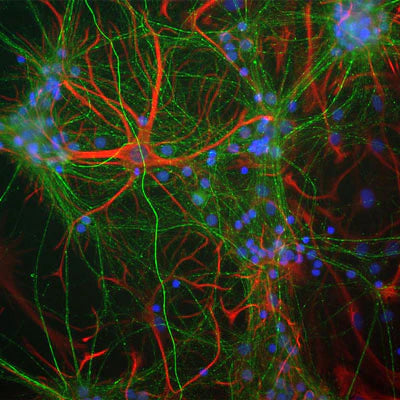 Immunocytochemical staining of NF-M immunoreactivity (green) and Glial Fibrillary Acidic Protein (GFAP, red) in a culture of mouse cortical neurons. The chicken anti-NFM immunostaining was performed using a 1:2000 dilution, and the GFAP immunostaining was performed using a 1:5000 dilution. Photomicrographs from Dr. Gerry Shaw, EnCor Biotechnology, Inc.