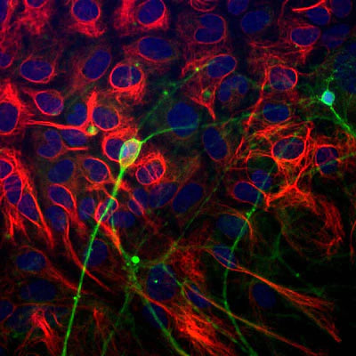 Immunostaining of paraformaldehyde-fixed (4%) neonatal mouse brain cultures showing β-Tubulin 3 immunostaining (green, 1:1000). Red staining is rabbit-anti-GFAP, blue is DAPI nuclear counterstain. Secondary antibodies were fluorescein-labeled goat anti-chicken IgY; Texas Red-labeled goat anti-rabbit IgG. Image from Dr. Gerry Shaw (EnCor Biotechnology).