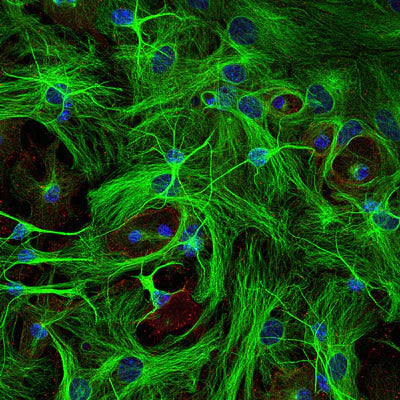 Immunostaining of paraformaldehyde-fixed (4%) cultures of SpH64 neuroblastoma cells showing β-Tubulin 3 immunostaining (green, 1:1000). Red staining is rabbit-anti-actin (1:1000); blue is DAPI nuclear counterstain. Secondary antibodies were fluorescein-labeled goat anti-chicken IgY (Cat. No. F-1005, 1:1000); Texas Red-labeled goat anti-rabbit IgG.  Page Balisch (University of Arizona).