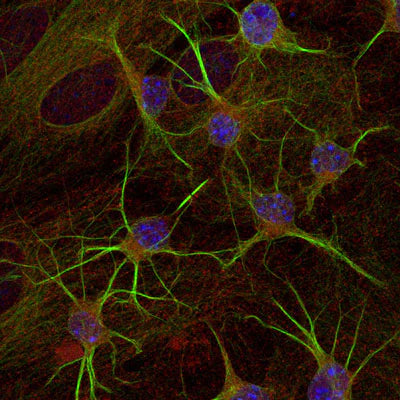 Immunostaining of paraformaldehyde-fixed (4%) cultures of SpH64 neuroblastoma cells showing β-Tubulin 3 immunostaining (green 1:1000). Red staining is rabbit-anti-actin (1:1000); blue is DAPI nuclear counterstain. Secondary antibodies were fluorescein-labeled goat anti-chicken IgY (Cat. No. F-1005, 1:1000); Texas Red-labeled goat anti-rabbit IgG. Page Balisch (University of Arizona).