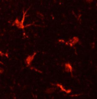 Higher-power view of MAC1 immunoreactivity in microglial cells in a paraformaldehyde (4%)-fixed paraffin-embedded section through cerebral cortex of an adult mouse brain.  1˚ antibody was Aves Labs' anti-MAC1 antibody (1:2000 dilution); 2˚ antibody was a Texas Red goat anti-chicken IgY (Jackson ImmunoResearch; 1:1000 dilution).