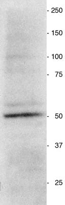 Vimentin western blot of a homogenate prepared from a neurosphere culture. Vimentin antibody, 1:2000; Secondary, HRP-labeled goat anti-chicken antibody (Aves Labs, Cat.No. H-1004), 1:1000. Hoda Ilias, Aves Labs.